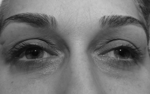 lash-lift1-300x188
